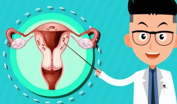 连云港56岁助孕龙凤胎-一个真实的案例研究--一个子宫内膜异位症患者的成功体外受精经验。